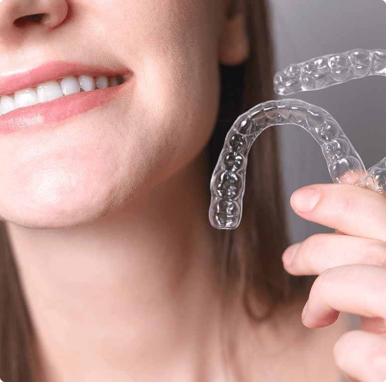 Invisalign aligner