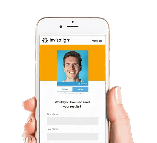 Invisalign phone