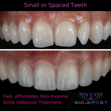 SmileFast at Grange Green Dental Practice in Billericay