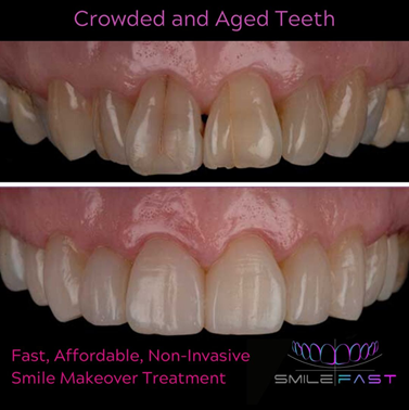 Smile Gallery at Grange Green Dental Practice in Billericay