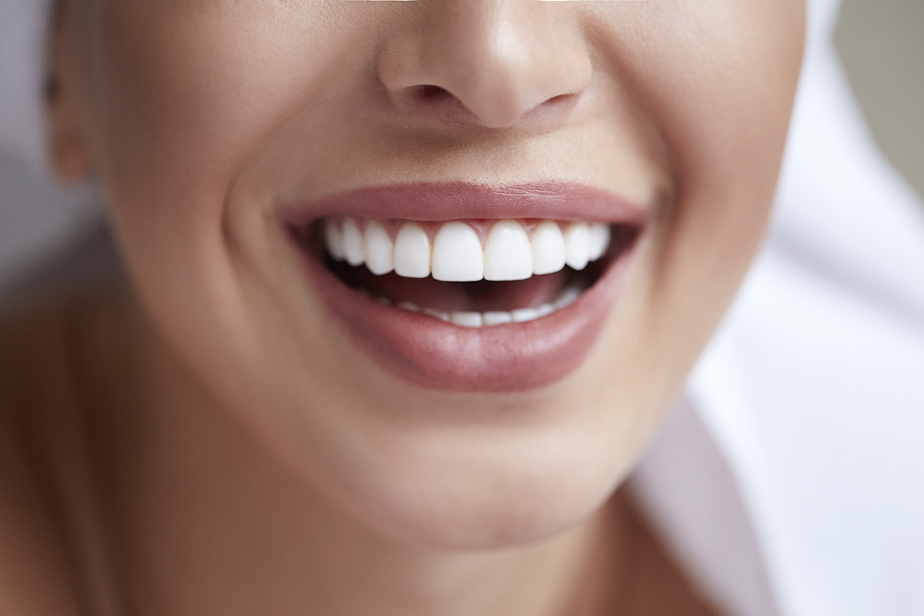 Dental Veneers at Grange Green Dental Practice in Billericay